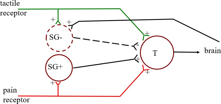 Wiring diagram of gate control theory. Facilitatory connections shown with a + and solid lines and inhibitory connections shown with a – and dotted lines.