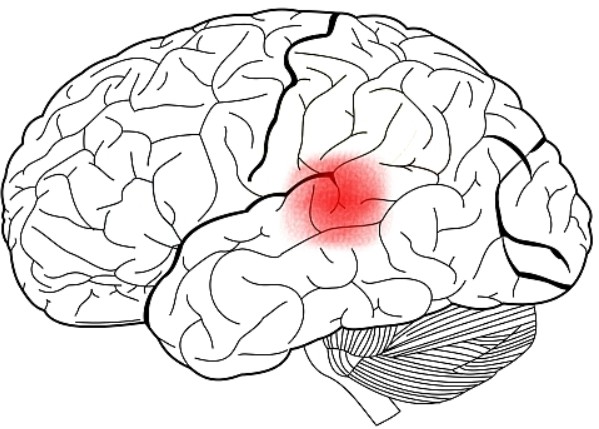 Diagram showing Wernicke's area.