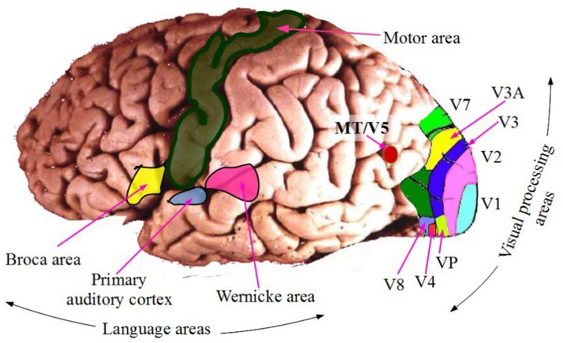 A side view of the human brain. MT/V5 appears toward the back of the brain.